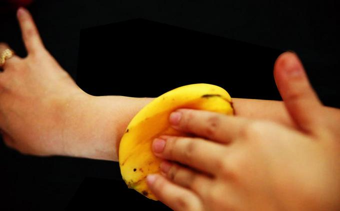 Banana piele ameliorează perfect mâncărime la înțepături de țânțar