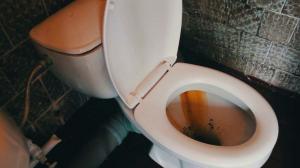 Cum pentru a curăța rapid și ușor la toaleta de rugina si placa galben?